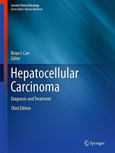 Cover for Hepatocellular Carcinoma