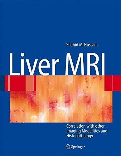 Cover for Liver MRI: Correlation with other Imaging Modalities and Histopathology