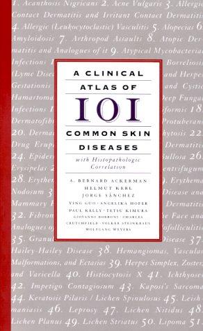 Cover for A Clinical Atlas of 101 Common Skin Diseases