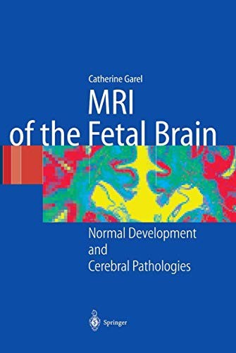 Cover for MRI of the Fetal Brain