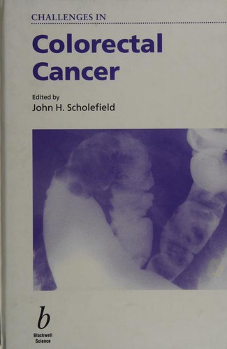 Cover for Challenges in Colorectal Cancer (Challenges in)