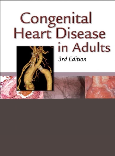 Cover for Congenital heart disease in adults