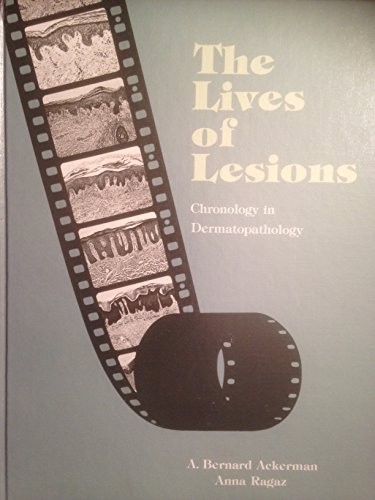 Cover for The lives of lesions