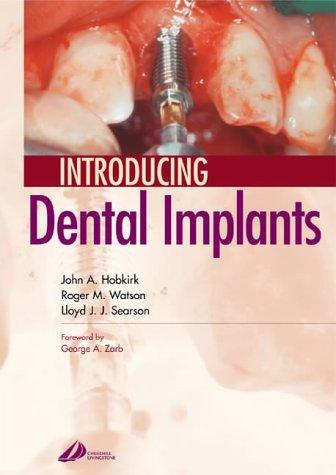 Cover for Dental implants