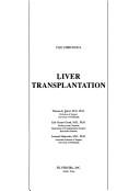 Cover for Liver transplantation