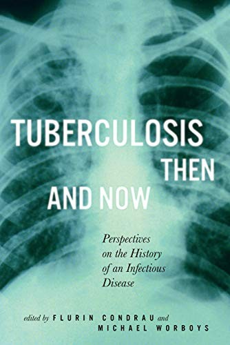 Cover for Tuberculosis Then and Now
